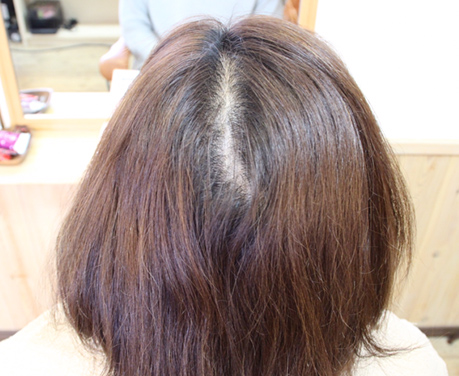 事例2