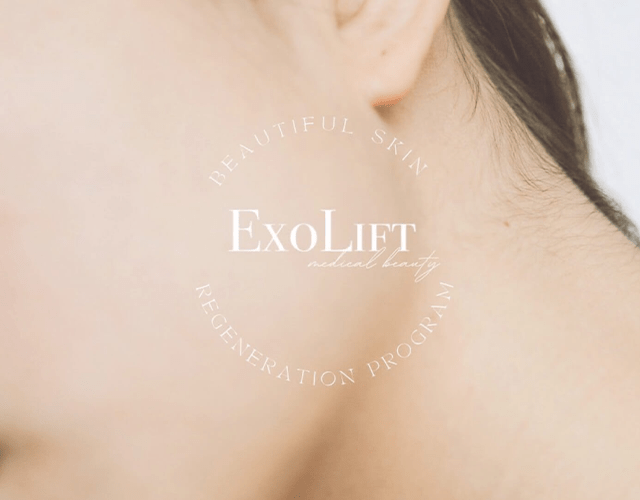 ExoLift